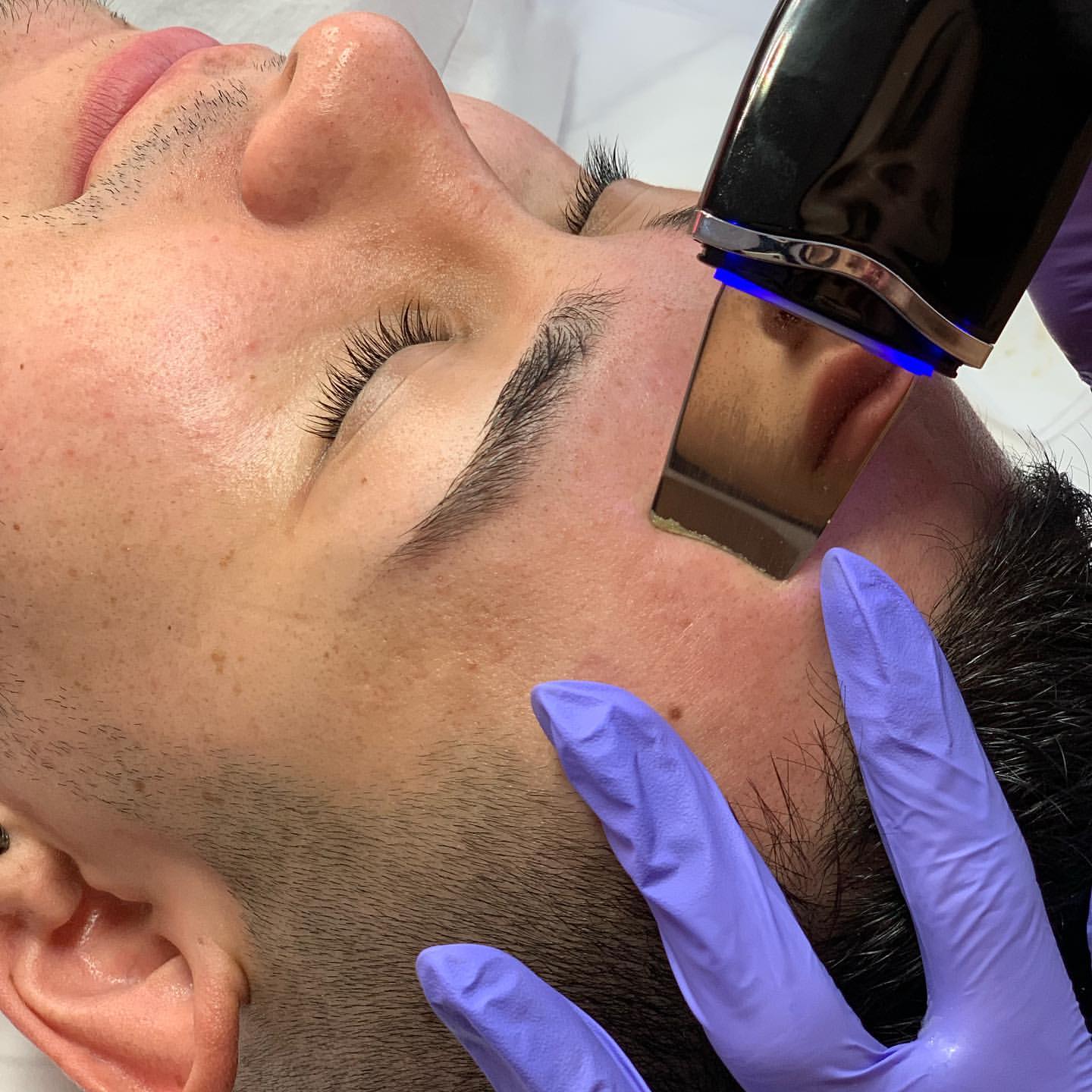 Ultrasonic Face Skin Scrubber