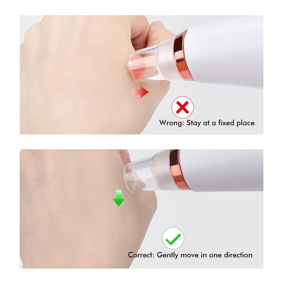 Vacuum Deep Pore Cleaner Blackhead Remover