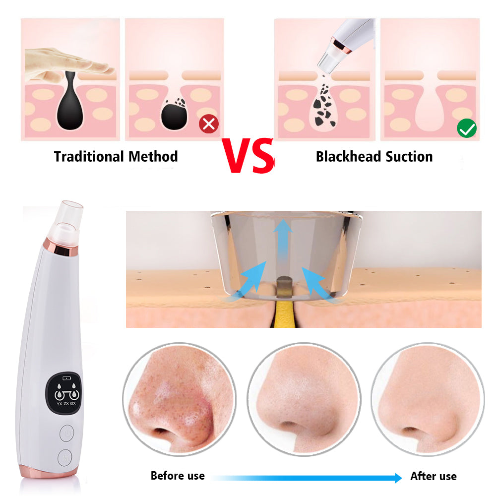 Vacuum Deep Pore Cleaner Blackhead Remover