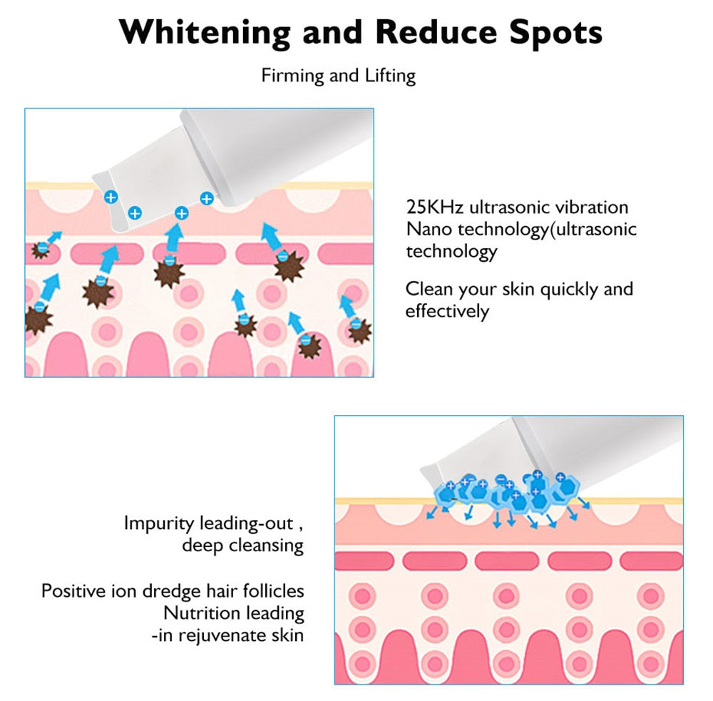 Ultrasonic Face Skin Scrubber
