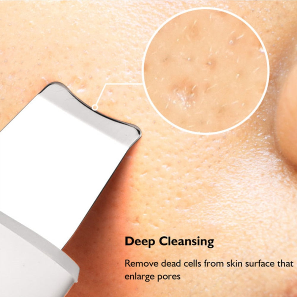 Ultrasonic Face Skin Scrubber