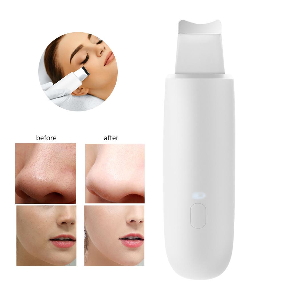Ultrasonic Face Skin Scrubber